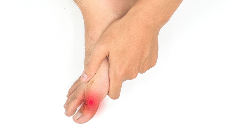 Diabetes Drug Class May Reduce Need for Gout Medications